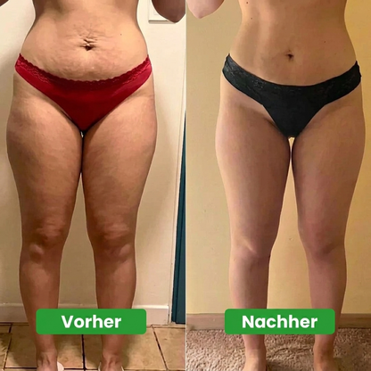 Norevora™ Lymphdrainage