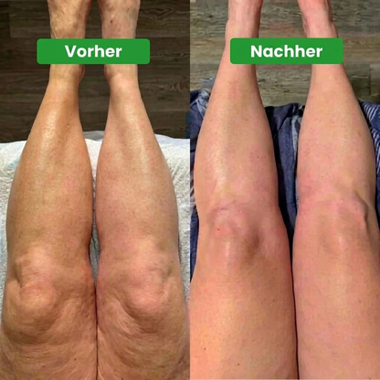 Norevora™ Lymphdrainage